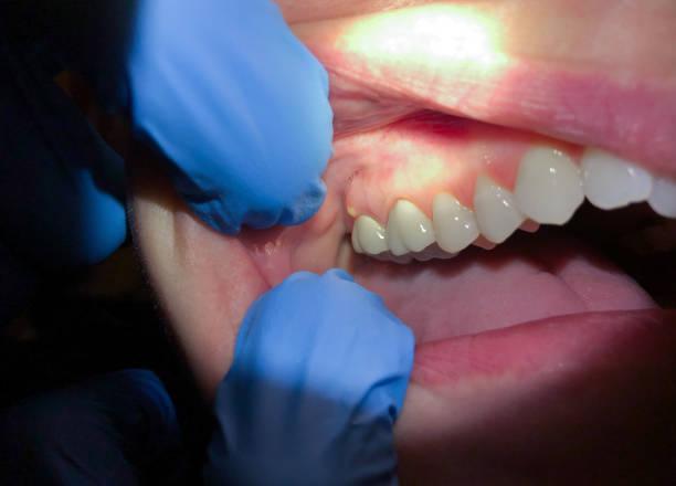 Best Cosmetic Emergency Dentistry in Athens, WV
